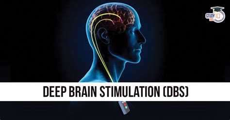 Deep brain stimulation mechanism of action.  DBS therapy is not always applied ...