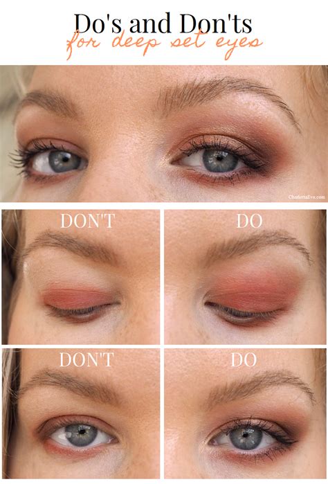 Deep set eyelids. Oct 4, 2017 · Hyaluronic acid (HA) injections are performed deep under the skin to fill out hollow areas and create a smoother transition between the eyelid and the cheek. When the desired effect is achieved, this usually lasts 9-12 months. In patients who also have lower eyelid ‘bags,’ the fat can be trimmed and repositioned to add volume.”. 