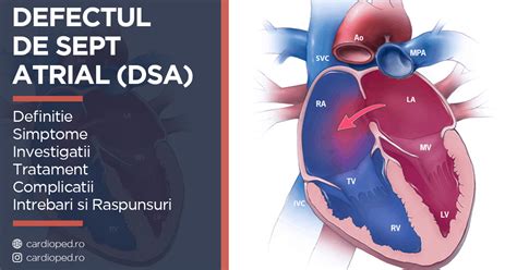 Defectul de sept atrial (DSA) - CardioPed.ro