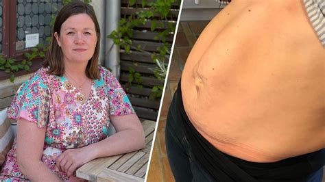 Delade magmuskler operation landstinget