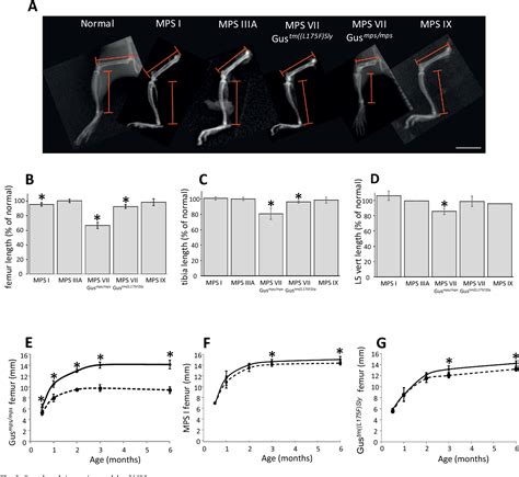 Delayed development of ossification centers in the tibia of …