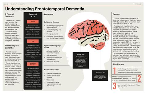 Dementia - PubMed