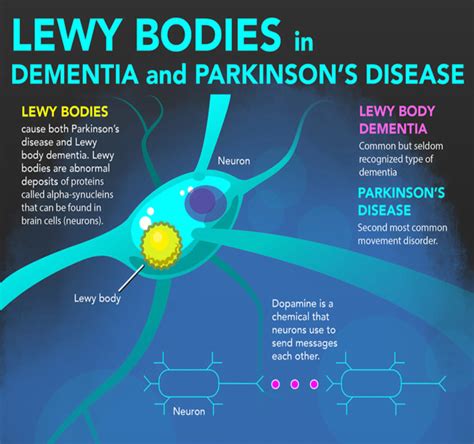 Dementia with Lewy Bodies and Parkinson Disease Dementia