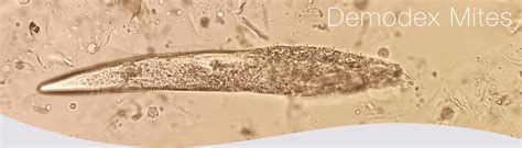 Demodex - Eyecare Virginia Beach