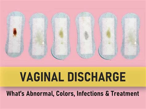 Demystifying Abnormal Vaginal Discharge Your Ultimate Guide