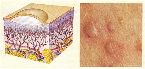 Dental Pathology 2 Flashcards Quizlet