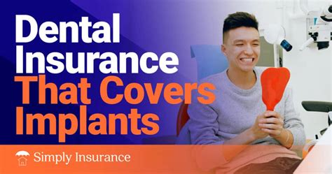 Dental insurance that covers dentures 100. Nov 14, 2023 · The Humana Extend 2500 plan is the best dental insurance plan for major dental work if you need a high maximum. It's similar to the 2500 plan, except the benefits for major services increase after the 1st year, and the plan maximum is $5,000 instead of $2,500. This means that the monthly premium is also higher, but it may be worth it if you ... 