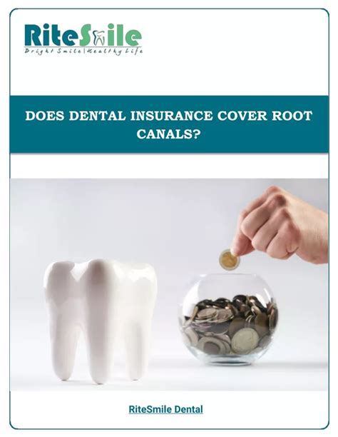 Dental insurance that covers root canals and crowns immediately. The average cost is $300 to $1000 for a root canal depending on the area in the U.S. the dentist is located. Dental Insurance For Root Canal - Here Are The Cheapest Rates We Found. Most insurance plans cover for root canal depending on the plan selected. To get your quote and coverage, please put your zip code and an instant quote will appear. 