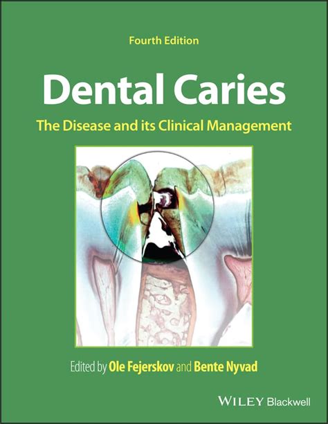 Download Dental Caries The Disease And Its Clinical Management By Ole Fejerskov