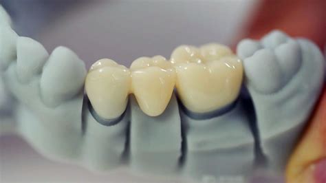 Read Dental Ceramics By Jw