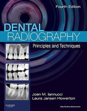 Full Download Dental Radiography Principles And Techniques By Joen M Iannucci