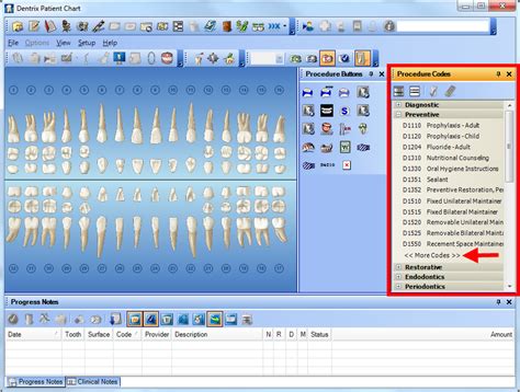 Dentrix Tip Tuesdays Customizing the Procedure Code List in the