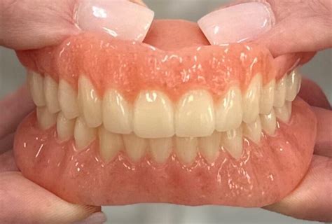 Dentures in Tyler, TX Affordable Dentures & Implants