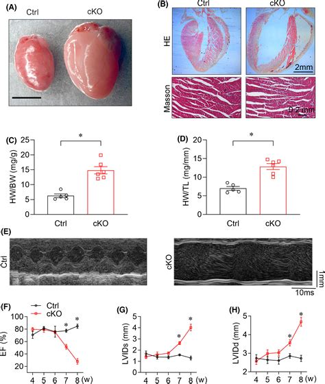 Depletion of m6A reader protein YTHDC1 induces dilated cardiomyopathy ...