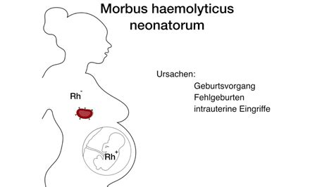 Der morbus haemolyticus neonatorum aus praktischer sicht. - Study guide for cna state test iowa.