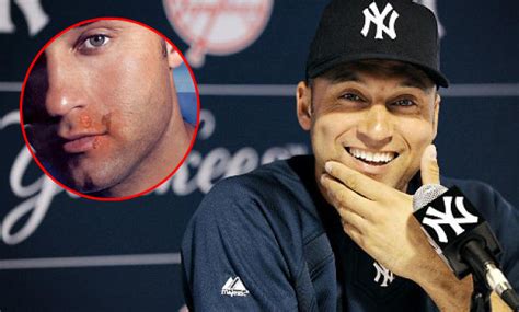 Derek jeter herpes. Oct 22, 2009 · We would like to show you a description here but the site won’t allow us. 