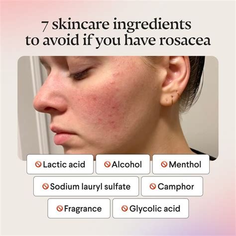 Dermatologist-approved skincare tips and products for rosacea