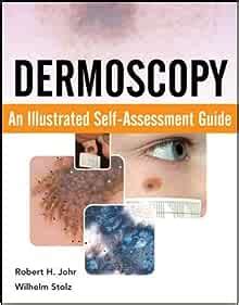 Dermoscopy an illustrated self assessment guide 1st edition. - Cockshutt 540 550 560 570 gas diesel tractor manual.
