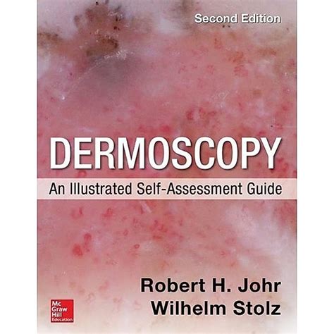 Dermoscopy an illustrated self assessment guide 2 e. - Instructor manual operations management krajewski ritzman.