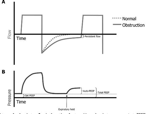 Detecting inspiratory holds in bedside waveforms using a