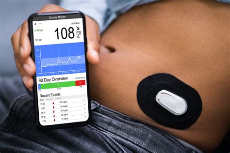 Dexcom Continuous Glucose Monitoring Dexcom