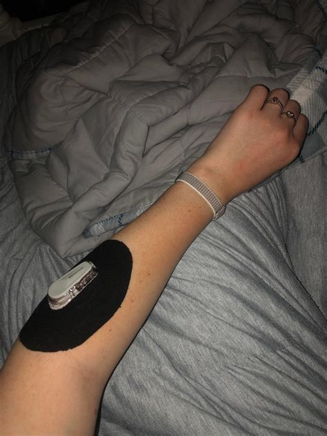 Dexcom g6 on forearm. When the Dexcom G6 or G7 sensor is in place, it can measure a user's glucose levels without fingerstick tests.* ... Users can wear the Dexcom G7 system's sensors on the abdomen, the upper arm, or (for youths using this system) the upper buttocks. Furthermore, the Dexcom G7's sensors are more comfortable than Dexcom's older sensors. ... 