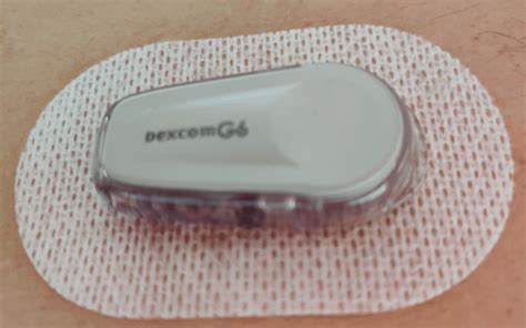 We designed the Dexcom G6 Continuous Glucose Monit