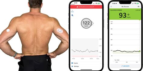 Dexcom vs libre 2020.  Oct 24, 2024 · In-depth review of Dexcom and Free...