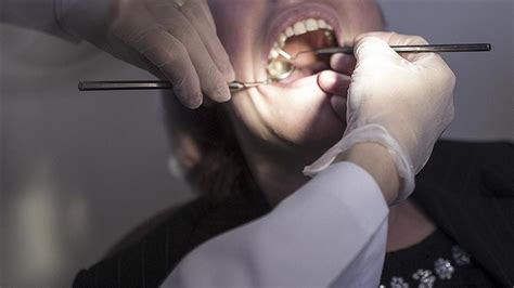 Dişçiye Giden Bir Vatandaştan Tedavi için İstenen Ücret Ağızları Açık Bıraktı!