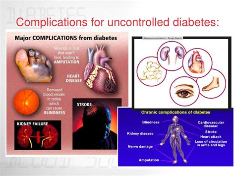 Diabetes Complications: How Uncontrolled Diabetes Affects Your B…