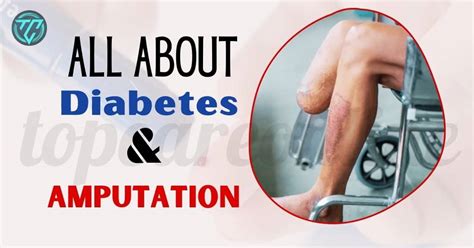 Diabetes and Amputation Why It s Done and How to Prevent It