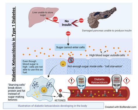 Diabetes insipidus You and Your Hormones from the Society …