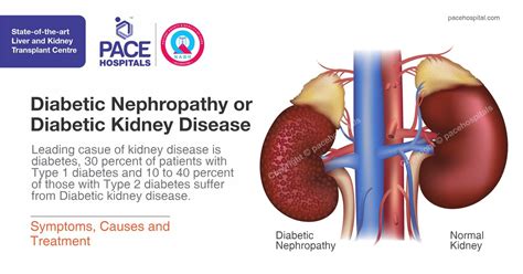 Diabetic Nephropathy: Symptoms, Treatment, and More