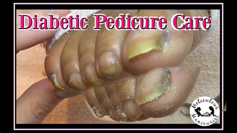 Diabetic pedicure near me. Things To Know About Diabetic pedicure near me. 