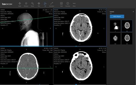 DICOM viewer. RadiAnt is a simple, fast and intuitive DICOM viewer for medical images. Store..
