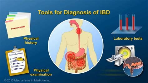 Diagnosing IBD YouTube