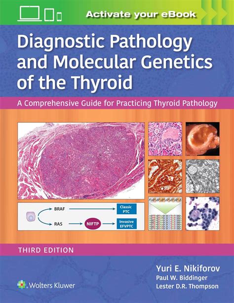 Diagnostic pathology and molecular genetics of the thyroid a comprehensive guide for practicing thyroid pathology 1. - Artt. 255 en 257 wetboek van strafrecht..