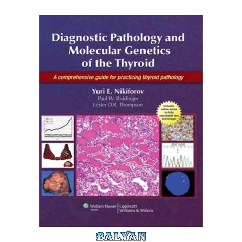 Diagnostic pathology and molecular genetics of the thyroid a comprehensive guide for practicing thyroid pathology. - R606 r756 r906 r90s bedienungsanleitung us models 1628.