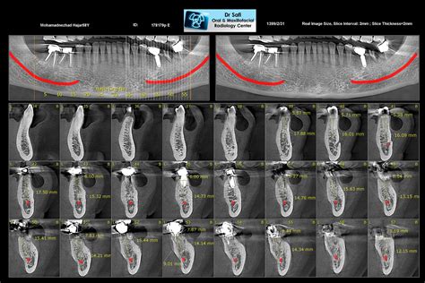 Diagnostic possibilities of cone-beam computed tomography …