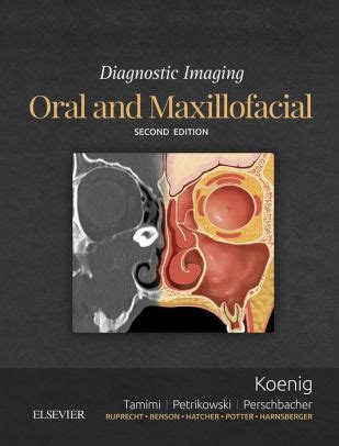 Download Diagnostic Imaging Oral And Maxillofacial By Lisa J Koenig