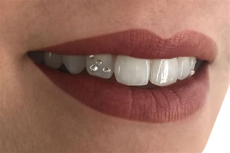 Diamond permanent teeth. We guess the pearly white teeth weren’t cutting it, so the rapper added diamonds to his top and bottom row of teeth to really seal the deal on having a hundred-thousand dollar smile. Seriously ... 