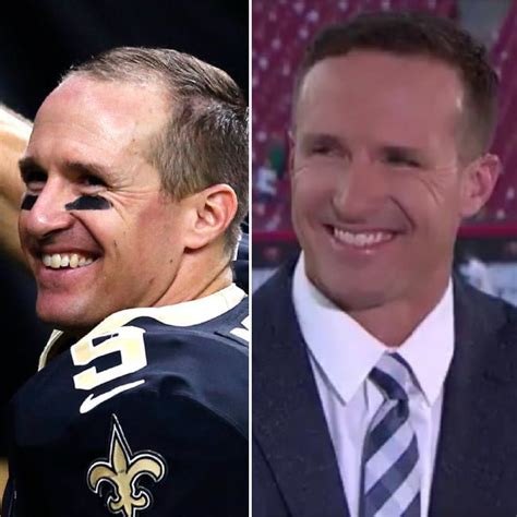 Did Drew Brees Get A Hair Transplant – Otosection