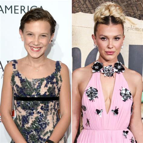 Did Millie Bobby Brown Get Plastic Surgery? Photos Then, Now