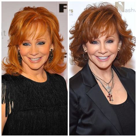 Did reba mcentire have plastic surgery. Things To Know About Did reba mcentire have plastic surgery. 