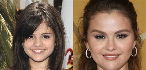 Did selena gomez get plastic surgery. Selena Gomez spoke candidly to "Billboard" about her relationship with her body after undergoing a kidney transplant and her plans for plastic surgery. 