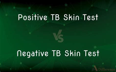 Difference Between Positive TB Skin Test and Negative TB Skin Test