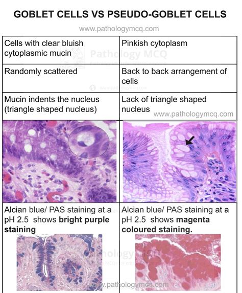 Differences in goblet cell differentiation between Crohn