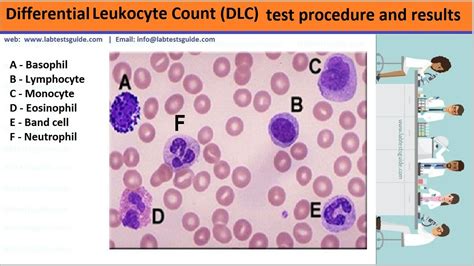 Differential Leukocyte Count (DLC) Test Procedure - Lab Tests …