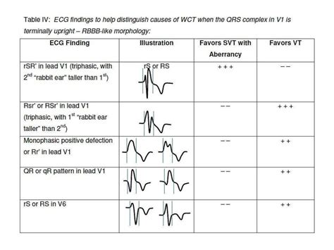 Differential diagnosis of wide QRS tachycardia: A review