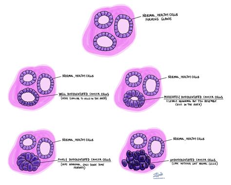 Differentiated MyPathologyReport.ca